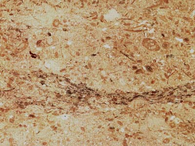 Chiampo Perlato · صورة من أرشيف مارمي دي كارارا