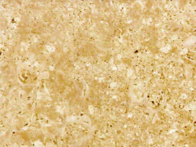 Niwala Peach · صورة من أرشيف مارمي دي كارارا