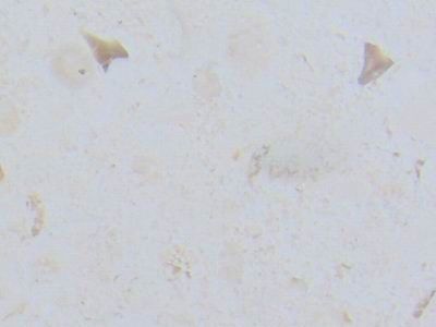 Finike White Fossil · صورة من أرشيف مارمي دي كارارا